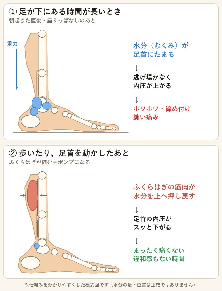 足を内側から見た模式図。上:足が下にある時間が長いと足首に水分(むくみ)がたまり内圧が上がってホワホワ・締め付け・鈍い痛みになる。下:歩いたり足首を動かすとふくらはぎの筋肉がポンプになって水分を上へ押し戻し、内圧が下がって痛くなくなる