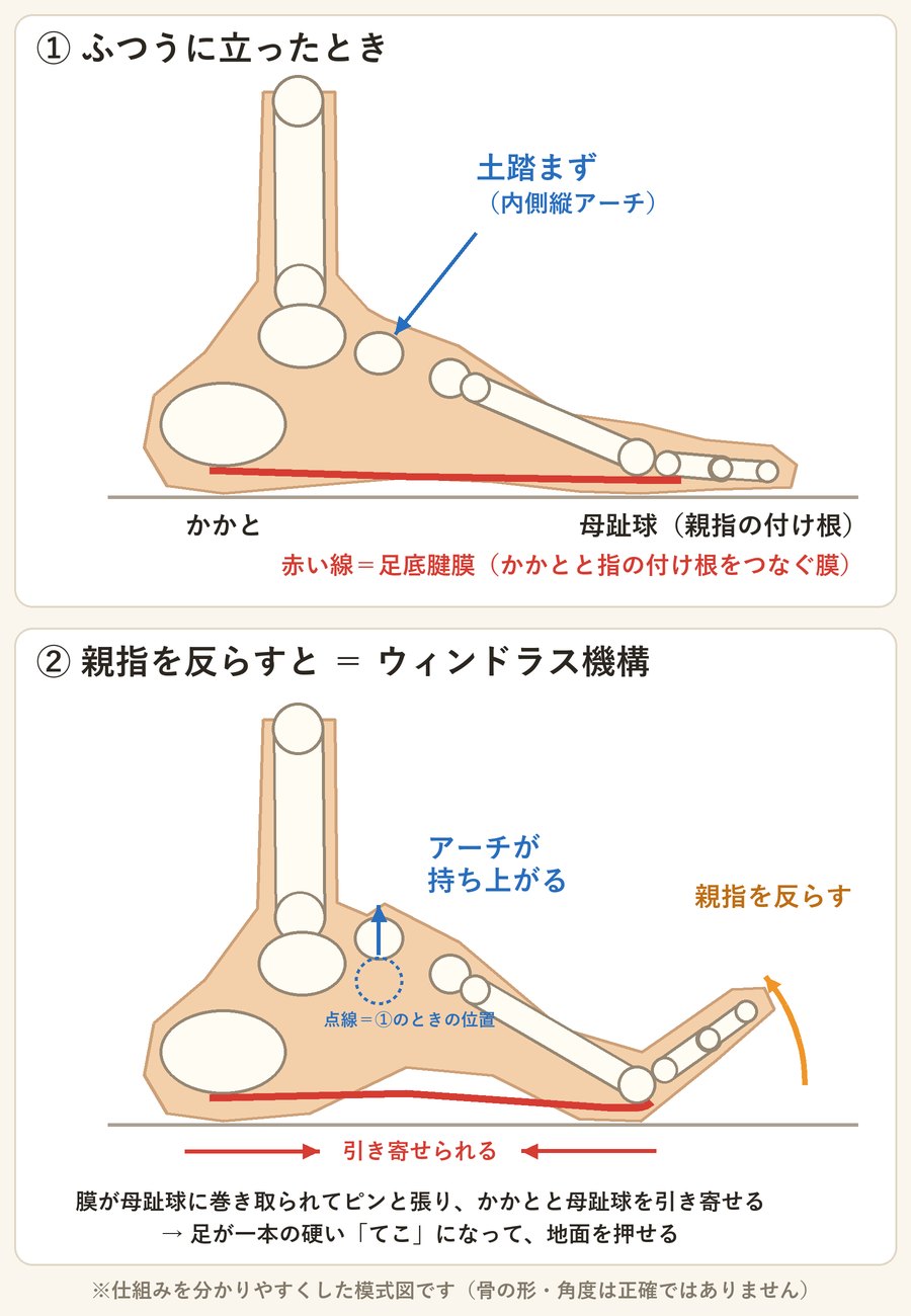 足を内側から見た模式図。上:ふつうに立ったときの土踏まず(内側縦アーチ)と足底腱膜。下:親指を反らすと足底腱膜が母趾球に巻き取られ、アーチが持ち上がるウィンドラス機構